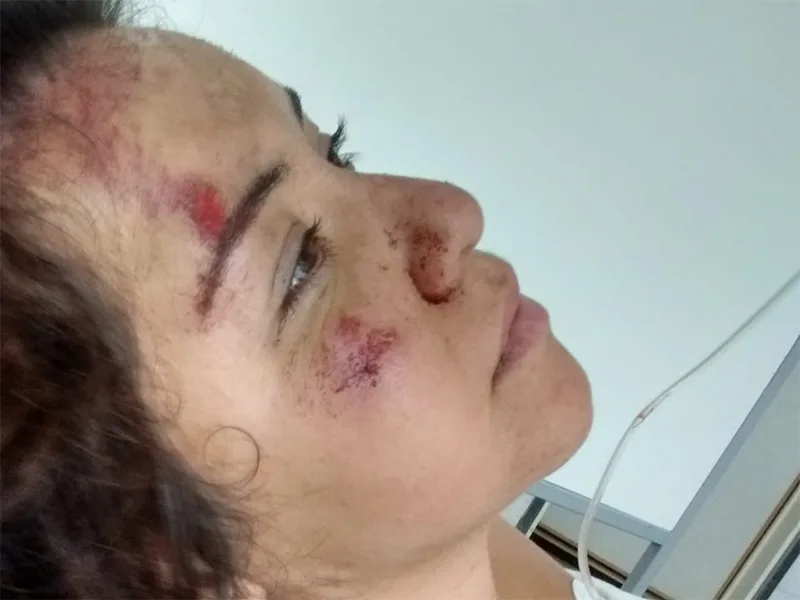 Imputaron al conductor que chocó a una ciclista en Sarmiento al 3000 y huyó