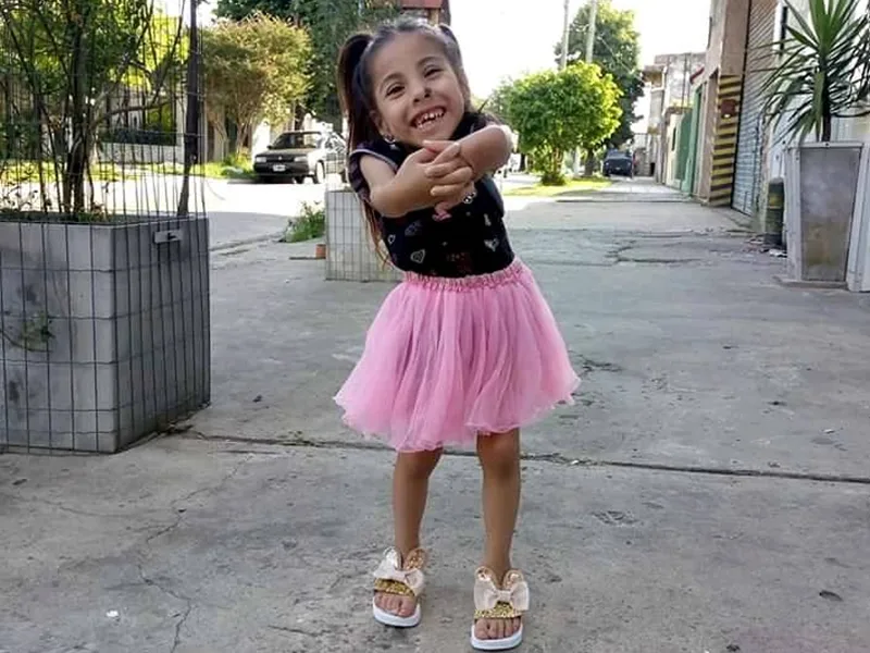 Piden ayuda para operar a Camila, una niña de 6 años con displasia de Kniest