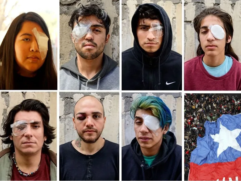 Carta abierta a Piñera, de un padre de joven que perdió un ojo en manifestación