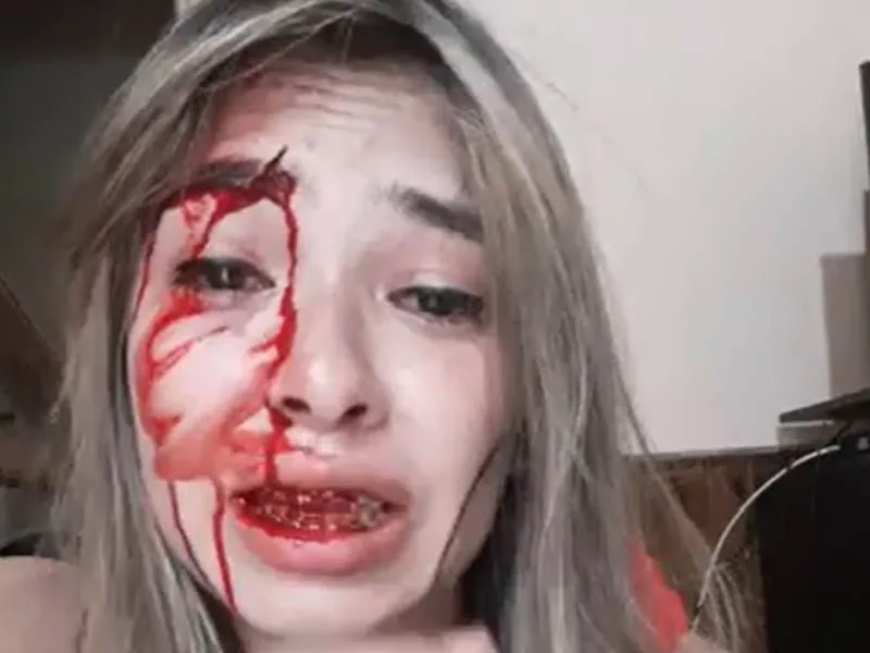Una joven fue brutalmente golpeada por su novio que fue liberado horas después