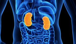 Cáncer de riñón: destacan la necesidad del diagnóstico a tiempo porque muchas veces no da síntomas en estadios tempranos