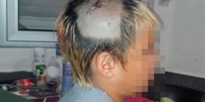 Absolvieron a policía y condenaron a ex subjefa por el caso del niño agredido en San Lorenzo