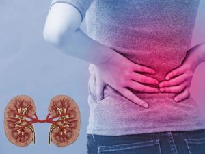 La hierba llena de fibra que elimina las piedras en los riñones y previene infecciones urinarias