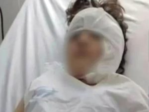 Un pitbull atacó a una niña en Río Gallegos, le desfiguró la cara: debe someterse a varias cirugías