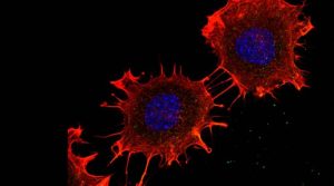 Desde Rosario estudian el rol de una proteína que podría ser clave para hallar una nueva terapia contra el cáncer de colon