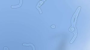 ¿Qué significan las manchas que vemos en el ojo después de mirar un fondo claro?