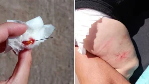 Una mujer llevó a vacunar a su bebé a una salita y denunció que le dejaron la aguja clavada en la pierna