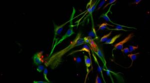 Investigadores rosarinos desarrollan terapia de origen biológico para tratar el Parkinson