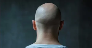 El compuesto natural que podría prevenir la calvicie, según un nuevo estudio