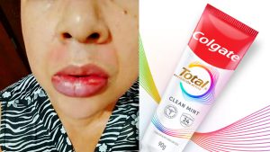 Ojo al lavarse los dientes: la Anmat prohibió dentífrico de famosa marca después de más de 11 mil casos comprobados de lesiones