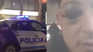 "Perdí un ojo": un famoso cantante popular fue molido a golpes por la Policía