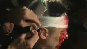 Cristian Mercatante periodista herido en el acto de Milei