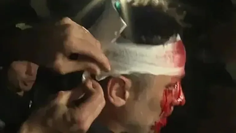 Cristian Mercatante periodista herido en el acto de Milei