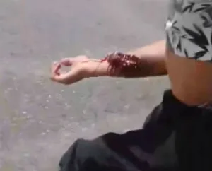 Puerto San Martín: un policía hirió con un tiro a un joven que volvía de bailar