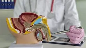 Cada vez más pacientes buscan revertir la vasectomía en Argentina