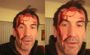 Asaltaron y golpearon al diputado Pablo Cervi, en la previa a las elecciones