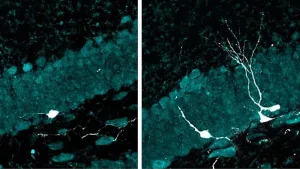 La estimulación sensorial intermitente impulsa la neurogénesis en cerebros envejecidos