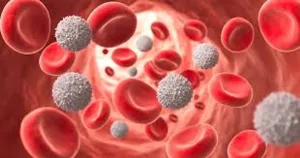 Enfermedad de Kawasaki: qué es y a quiénes afecta