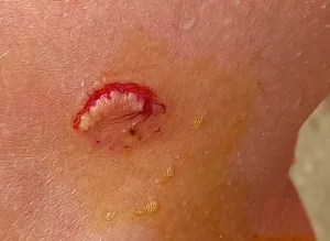 Palometas mordieron este martes a una nadadora en la Rambla Catalunya