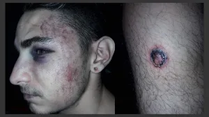 A ocho años de los hechos, se viene el juicio a 21 policías de Santa Fe por torturar a siete jóvenes en las Cuatro Plazas