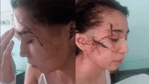 San Cristóbal: los agresores de Delfina, la joven brutalmente atacada a cuchillazos en enero pasado, eran compañeros del tirador