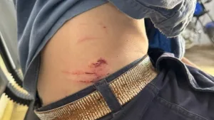 Santa Fe: un operario de la Epe fue atacado por jauría y hospitalizado