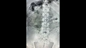 Radiografía del cuerpo