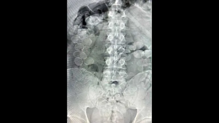 Radiografía del cuerpo