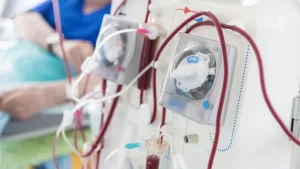 En Argentina, hay 30.000 pacientes en diálisis crónica
