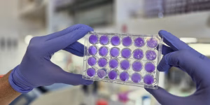 Argentinos hallan que dengue, Zika y fiebre amarilla se replican del mismo modo: se viene un antiviral