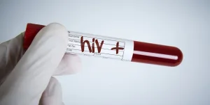Preocupa el crecimiento del diagnóstico tardío de VIH