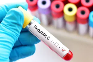 8 de cada 10 personas con hepatitis C aún no se trataron para curarse