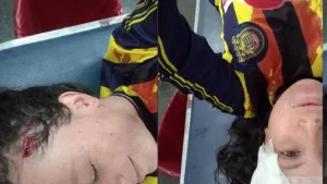 Una hincha de Central fue atacada a piedrazos por simpatizantes de Newell’s: «La saqué barata»