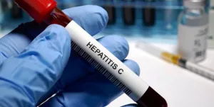 Argentina registra entre 700 y 800 casos de Hepatitis C cada año